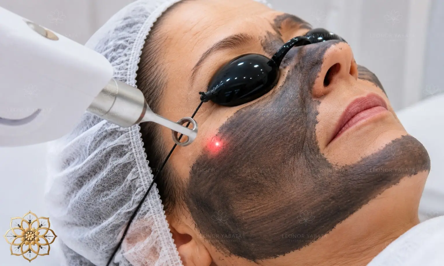Hollywood Peel, tratamiento de Estética Avanzada Leonor Llabata en Mallorca